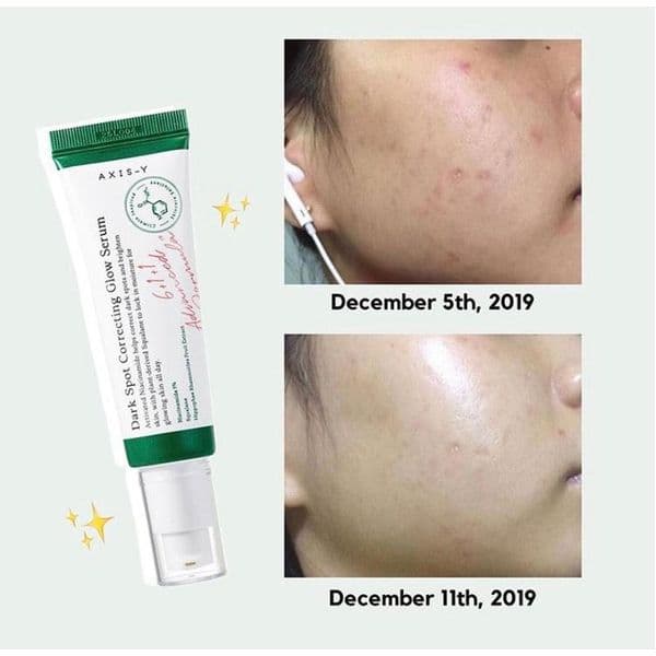 Сироватка для корекції темних плям AXIS-Y Dark Spot Correcting Glow Serum 2