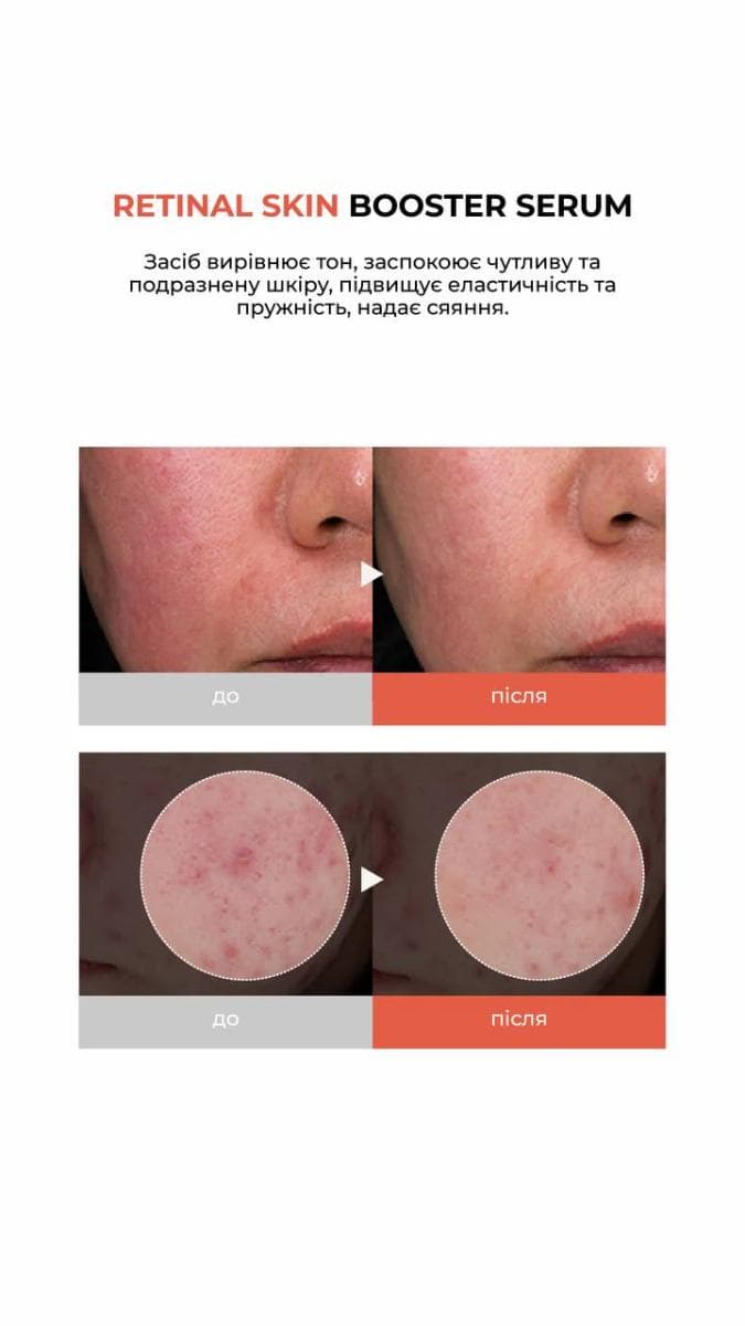 Зміцнювальна сироватка для обличчя з ретиналем MEDITHERAPY Retinal Skin Booster Serum 5
