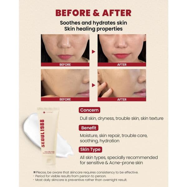 Заспокійливий крем з фільтратом слизу равлика та рисом K-SECRET SEOUL 1988 Cream : Snail Mucin 93% + Rice  2