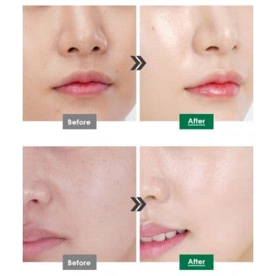 Омолоджувальна киснева есенція з центеллою Medi Peel Peptide 9 Volume White Cica Volume White Cica Essence Pro 3