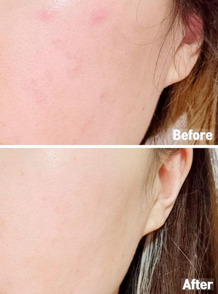 Сироватка з ніацинамідом та цинком JS DERMA Acnetrix Control AC Serum 3
