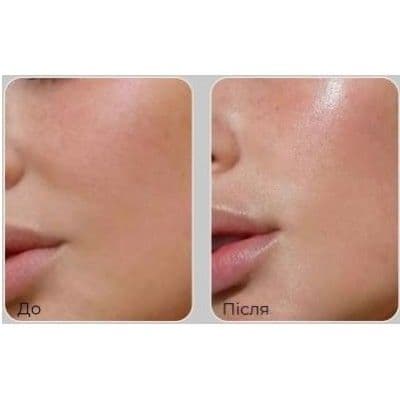 Ліфтинг-есенція для обличчя з пептидами Medi-Peel Peptide 9 Volume Lifting All-In-One Essence PRO 3