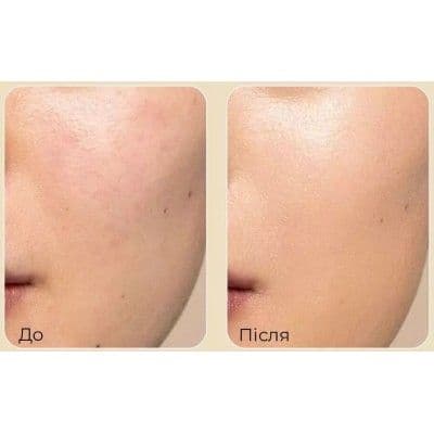 Крем для обличчя від зморшок Medi-Peel Premium Golden Camellia Wrinkle Cream 2