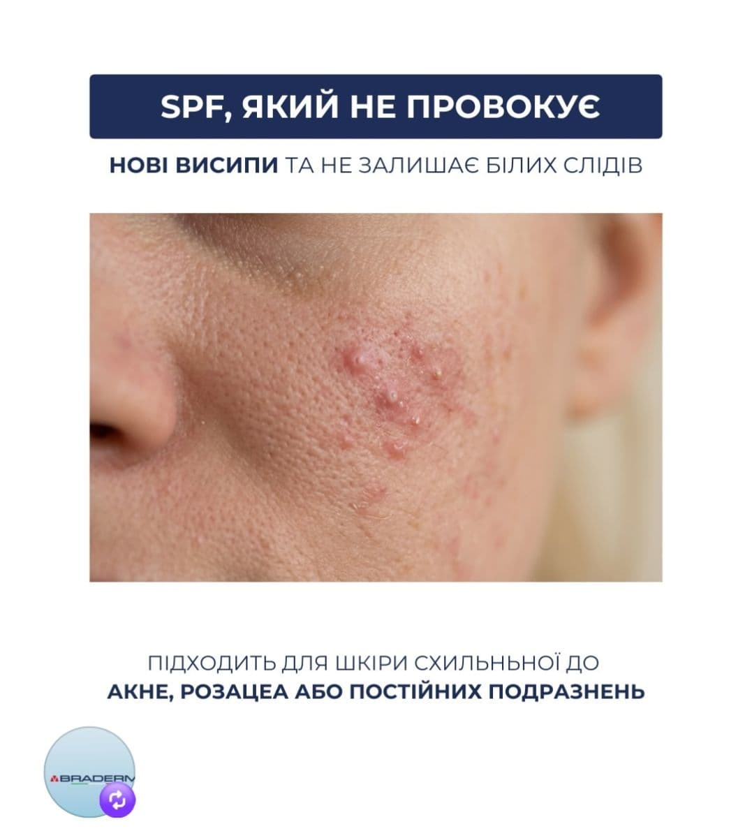 Сонцезахисний крем з протизапальним ефектом Braderm Azn Cream, 30 мл 2