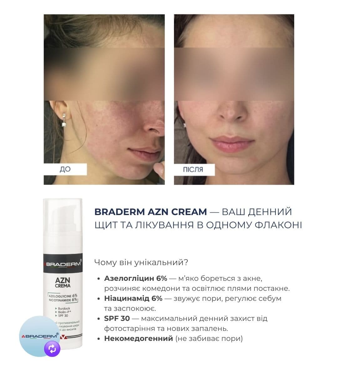 Сонцезахисний крем з протизапальним ефектом Braderm Azn Cream, 30 мл 3