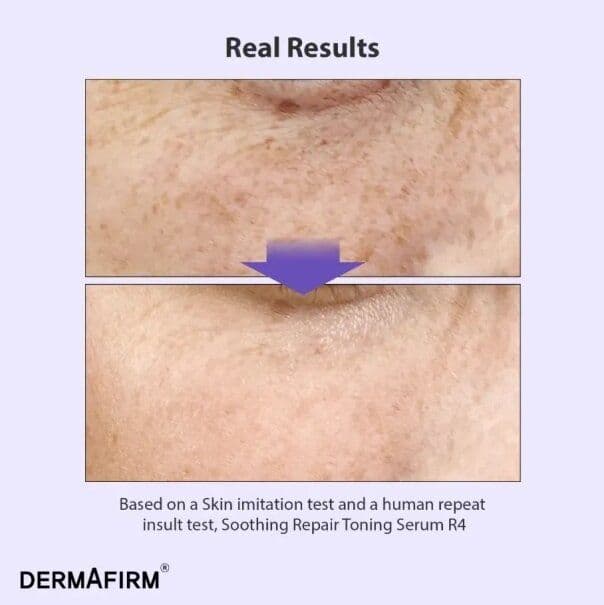 Мультифункціональна сироватка з бакучіолом Dermafirm Soothing Repair Toning Serum R4 3